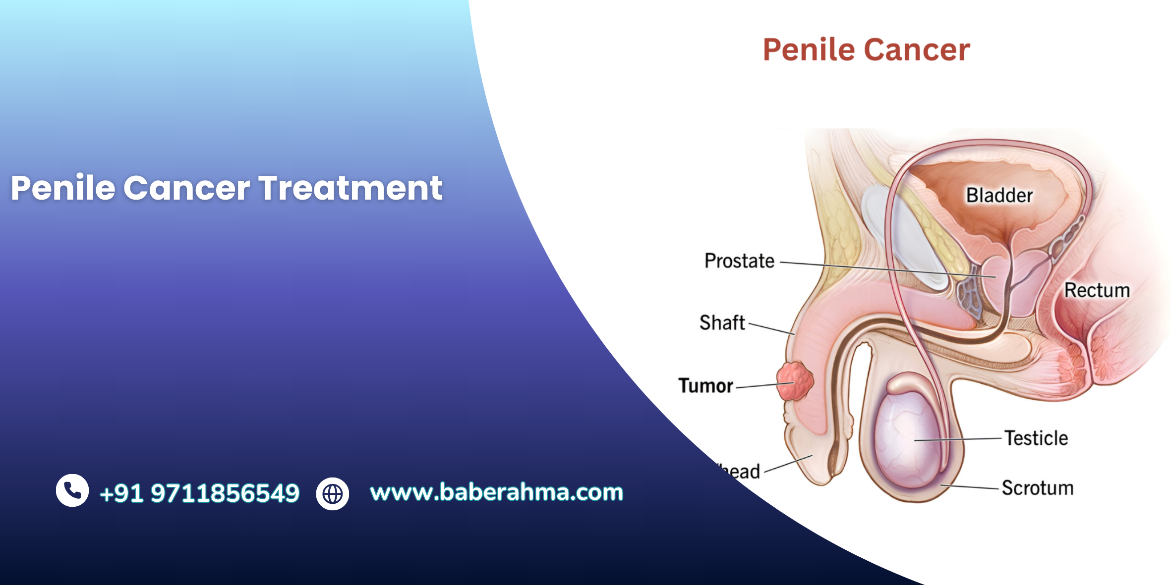 Procedure Image