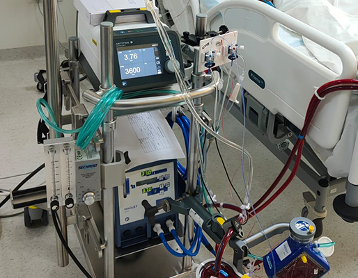 High-Frequency ventilation and ECMO