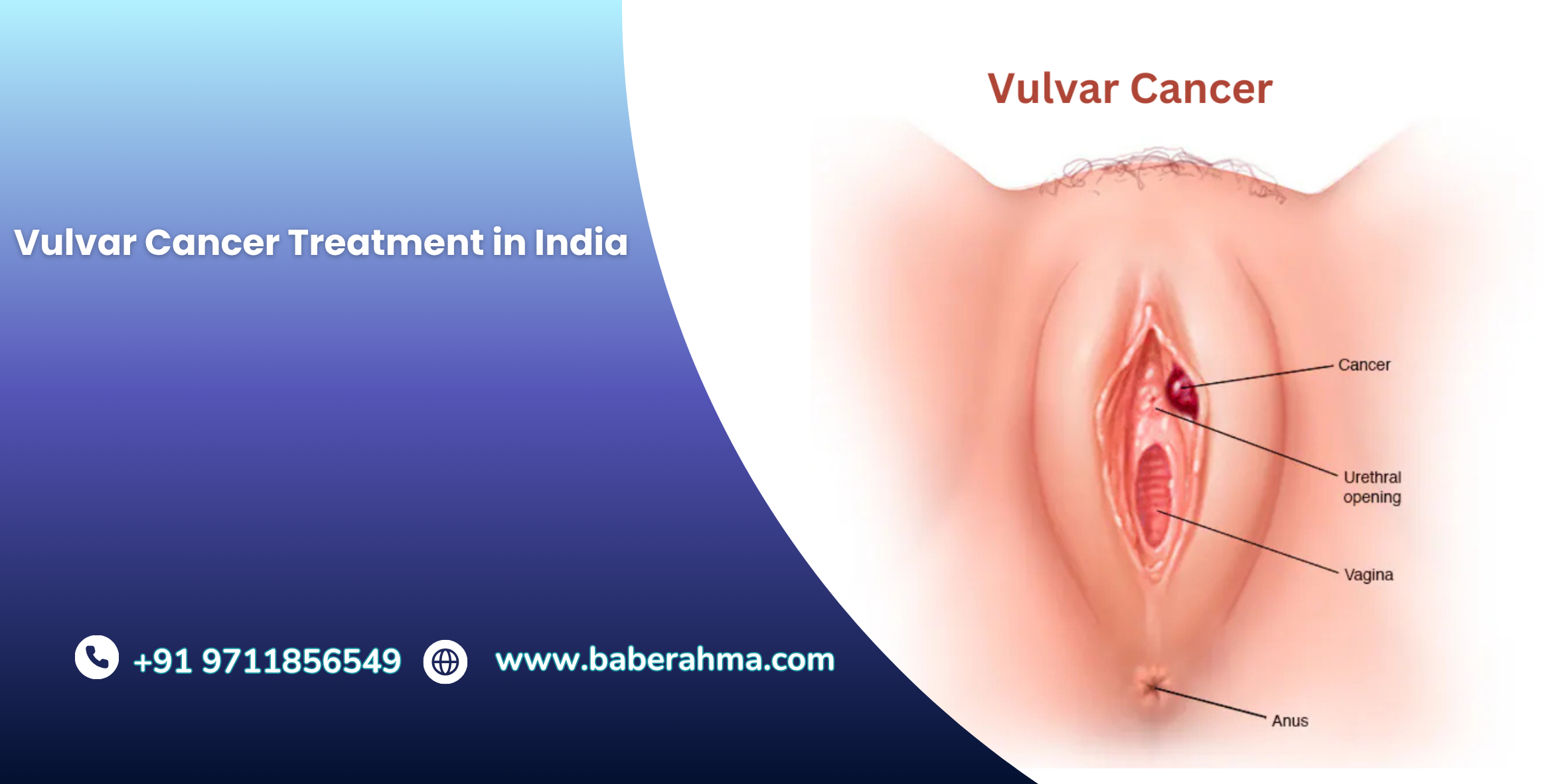 Procedure Image